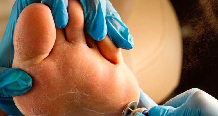 Podología-Biomotion-1