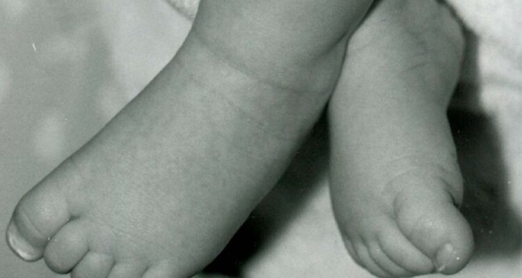 Podologia-infantil-biomotion