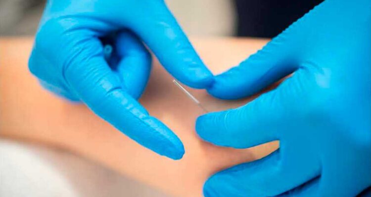 biomotion-puncion-seca